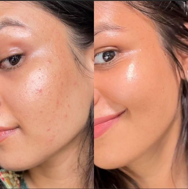Walis B Glow Enhancing Brightening Serum - Women