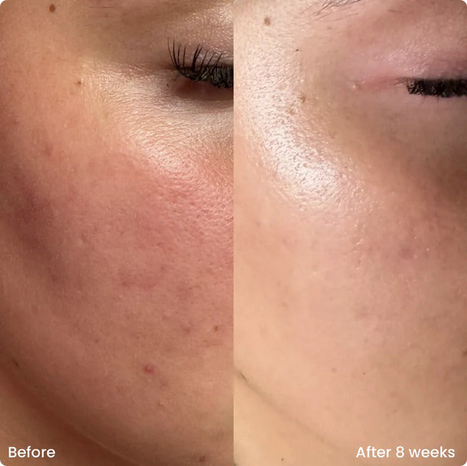 Walis B Pore Refining Niacinamide & Zinc Serum - Women