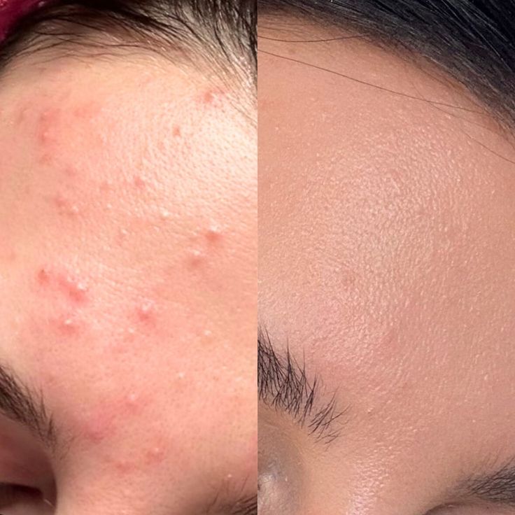 Walis B Pore Refining Niacinamide & Zinc Serum - Women