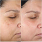 Walis B Anti-Aging Retinol Serum - Women